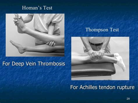 venous manual compression test|Homan's Sign Test .